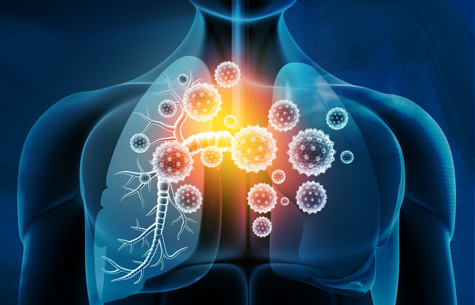 Infecțiile respiratorii, o provocare în contextul actual