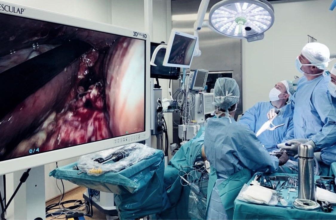 Operaţie de esogastrectomie robotică, în premieră naţională, la Braşov