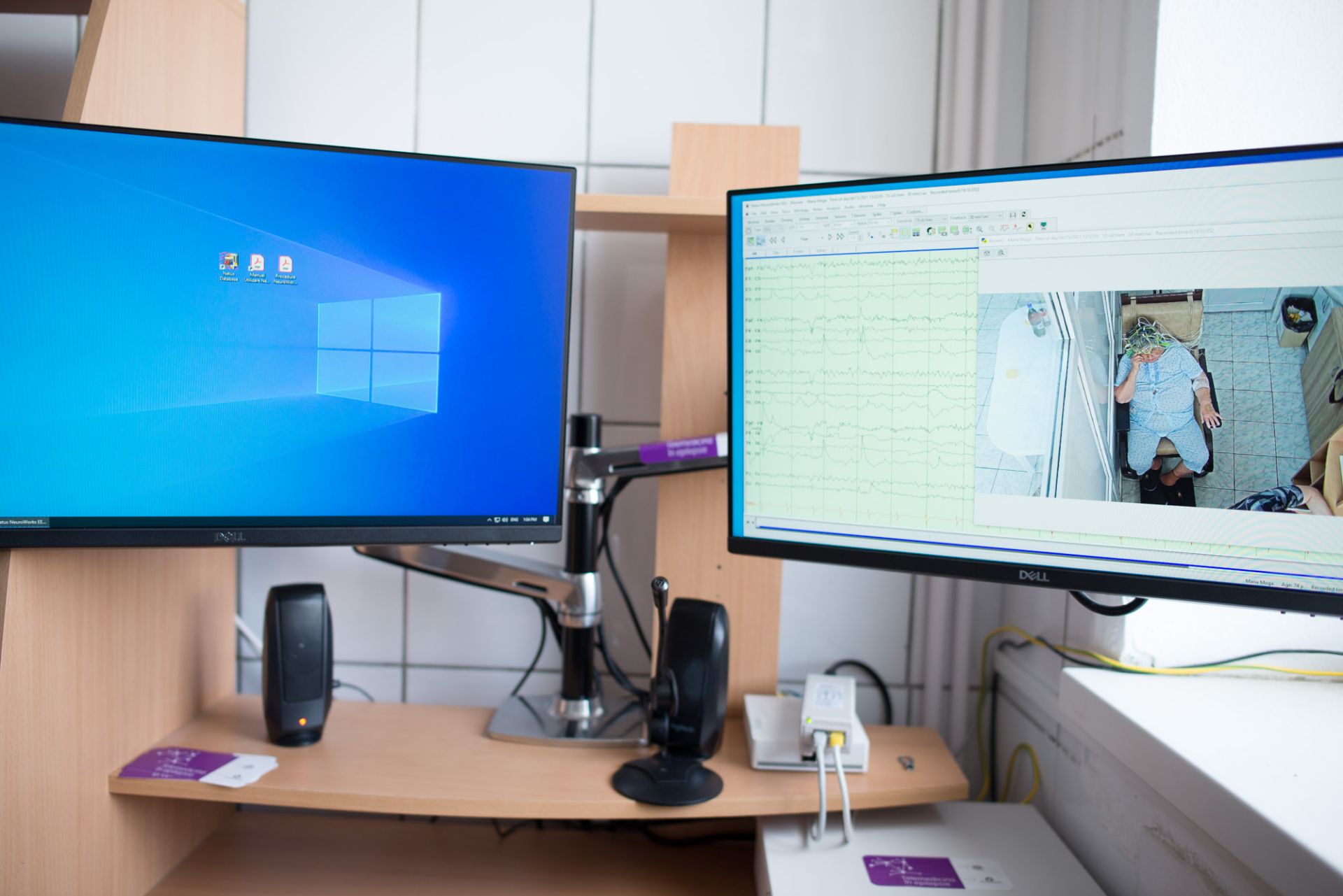 telemedicina in epilepsie investigatii