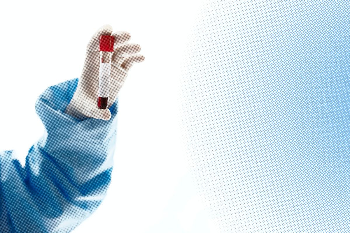 Descoperire: Test de sânge care depistează COVID-19 în 20 de minute