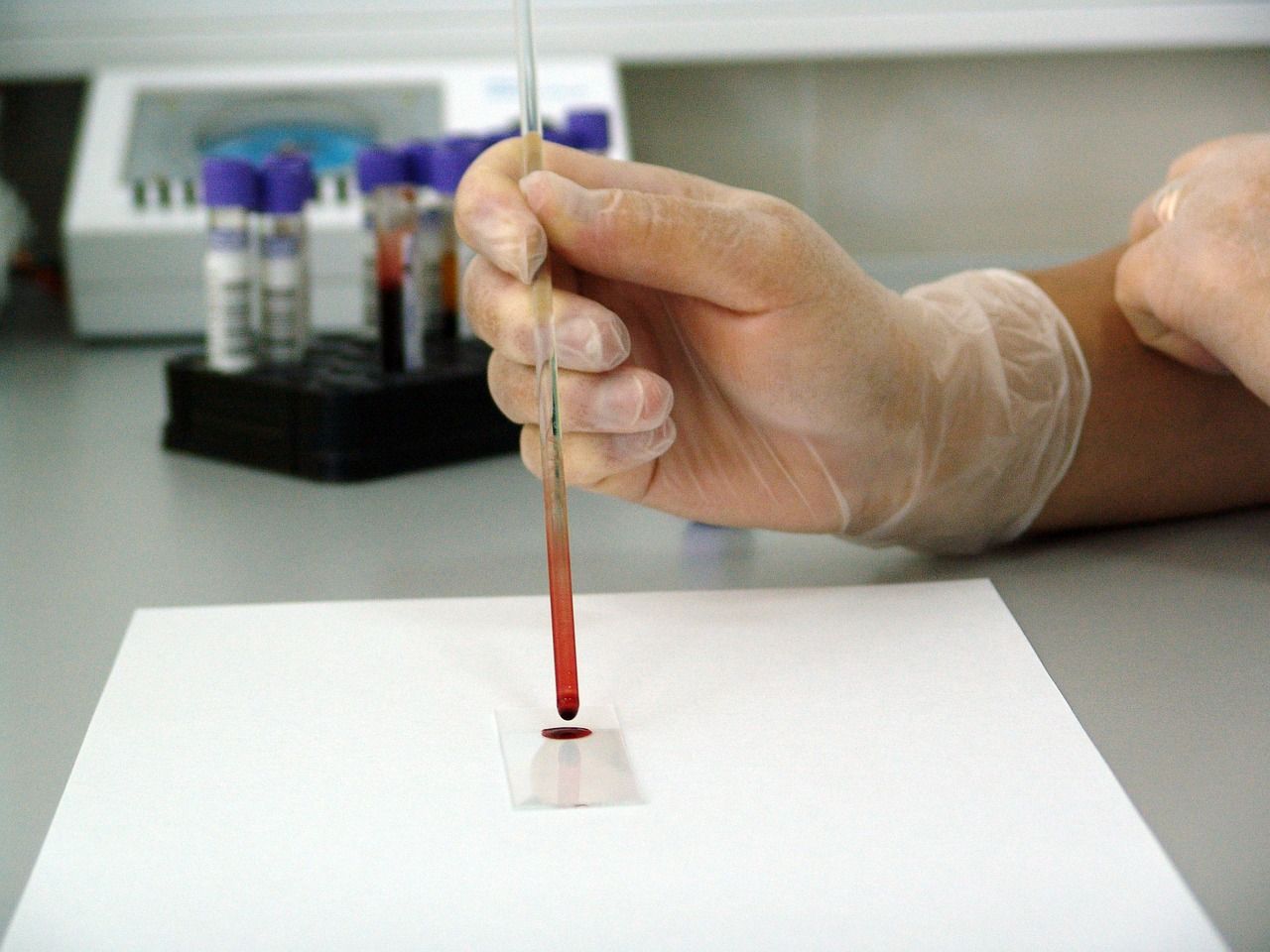 Test de sânge care poate depista 50 de tipuri de cancer, în studiu clinic