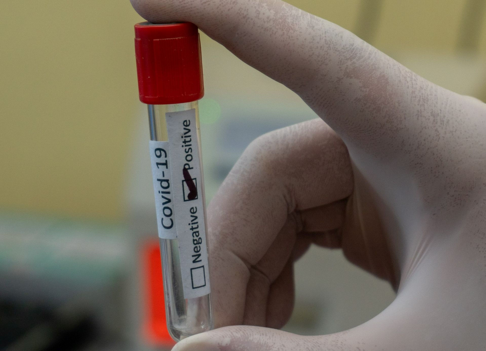 Un nou test PCR detectează rapid varianta Omicron