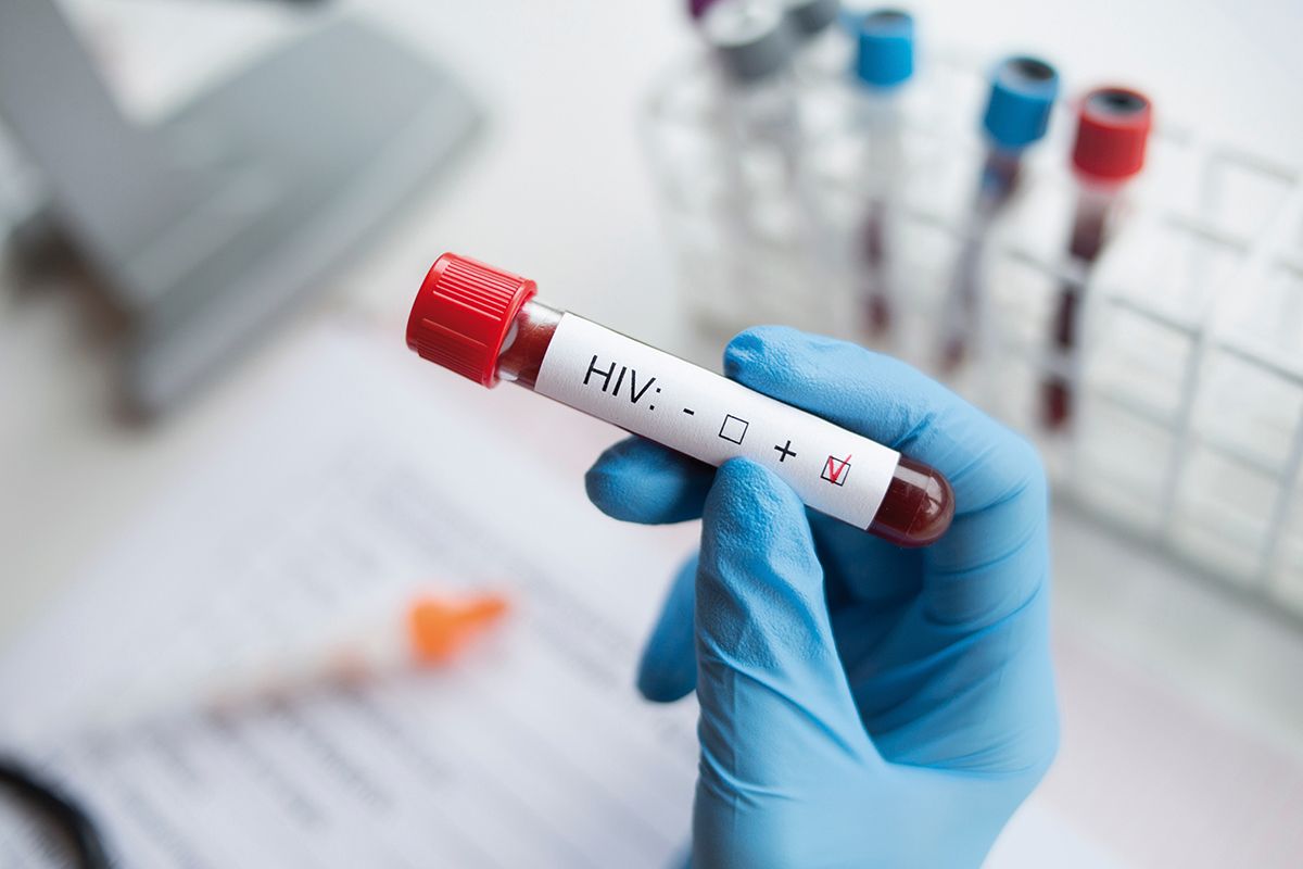 Teste pentru HIV la domiciliu, oferite în Marea Britanie