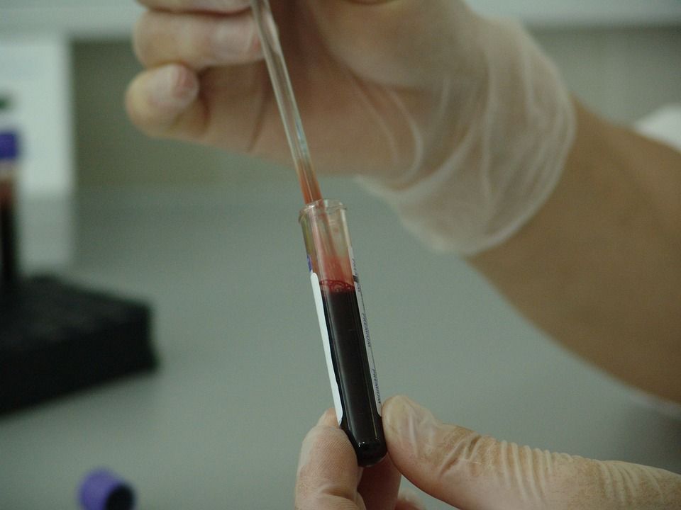 Studiu: un test de sânge ar putea depista precoce cancerul de sân