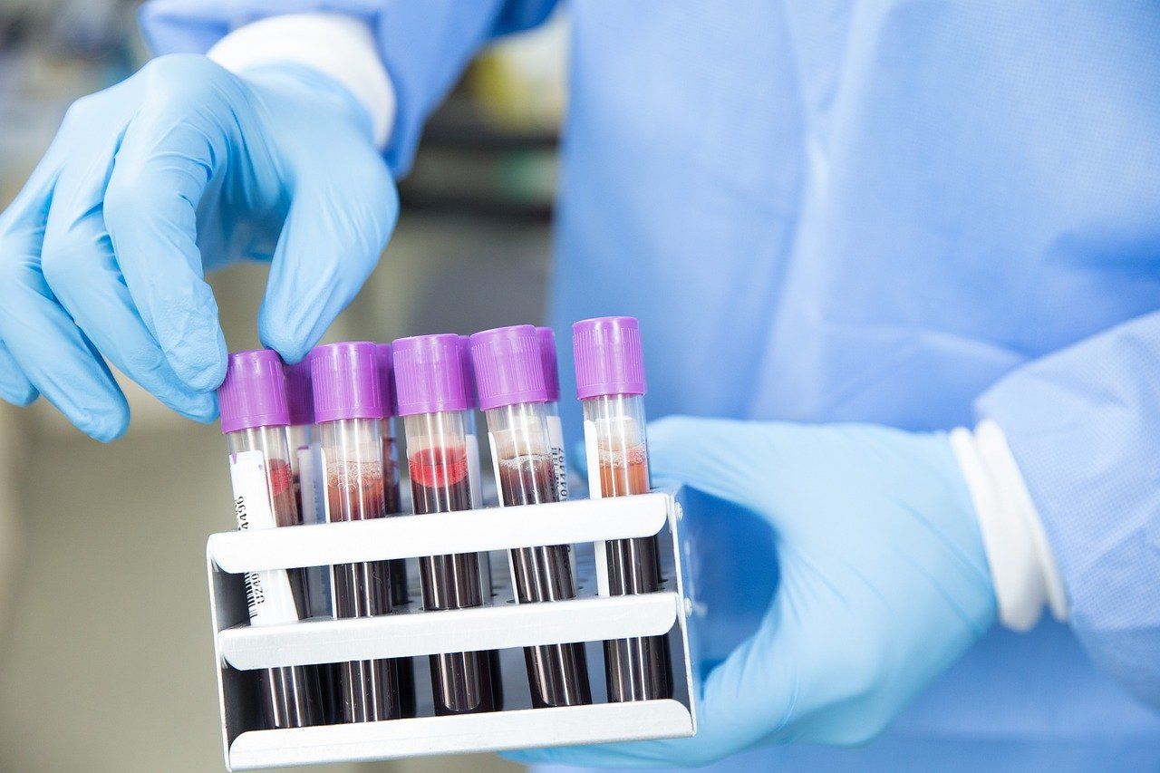 Un test detectează anticorpii împotriva SARS-CoV-2 în probe de sânge