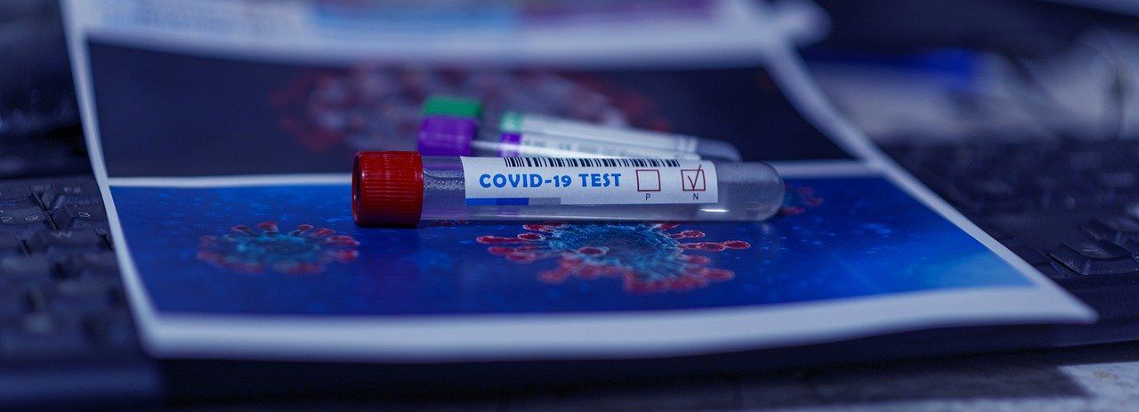 Teste COVID-19 la cerere, disponibile la Intermedicas