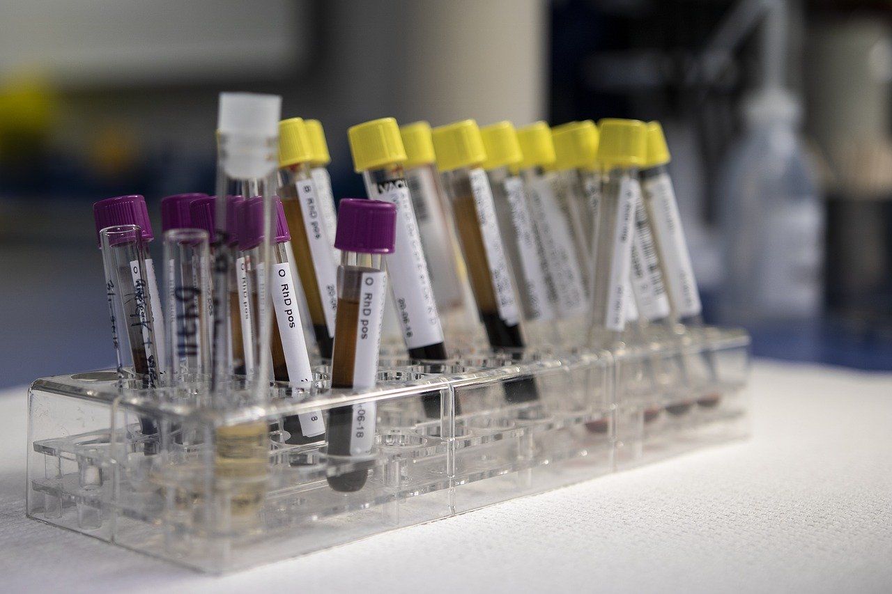 Un test de sânge ar putea arăta dacă scleroza multiplă se va agrava