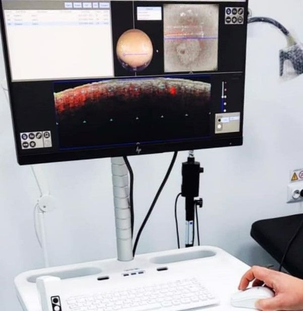 Galați: tomograf în coerență optică pentru Spitalul de Boli Infecțioase