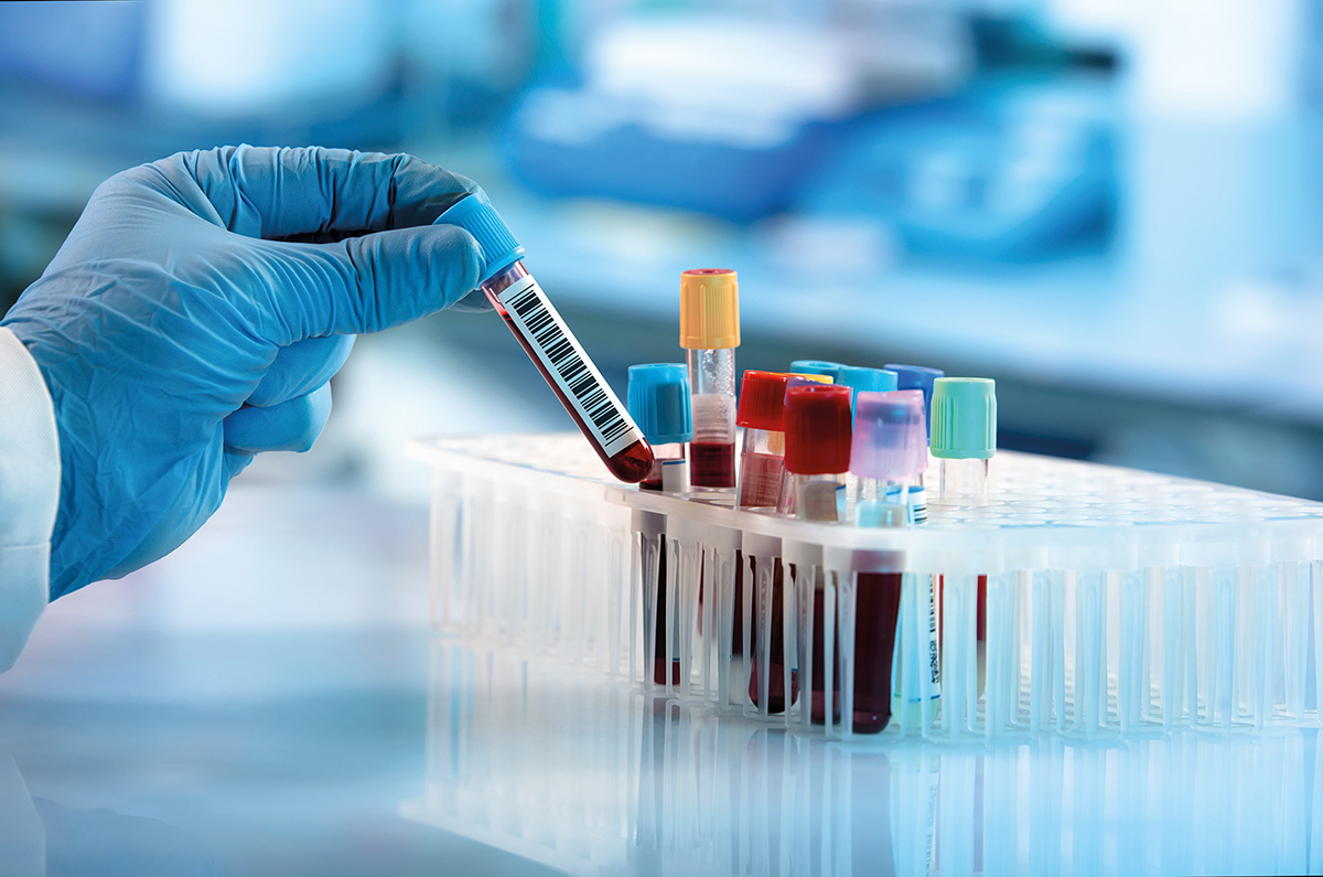 Investigaţii noi pe lista testelor de diagnostic esenţiale