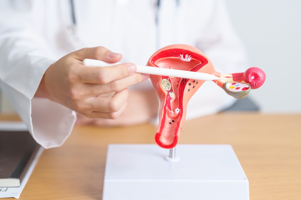 Conștientizarea semnelor de alarmă, o soluție în prevenirea cancerului ovarian