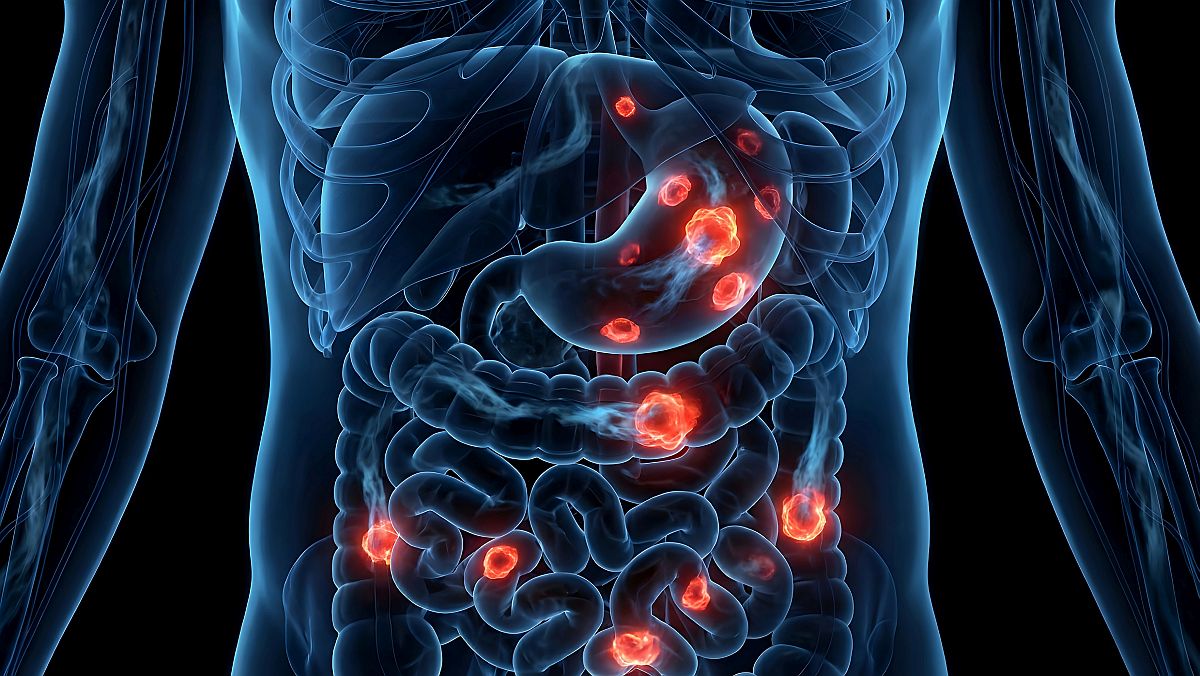 Izotopii medicali – Utilizarea tehnologiei nucleare dincolo de securitatea energetică