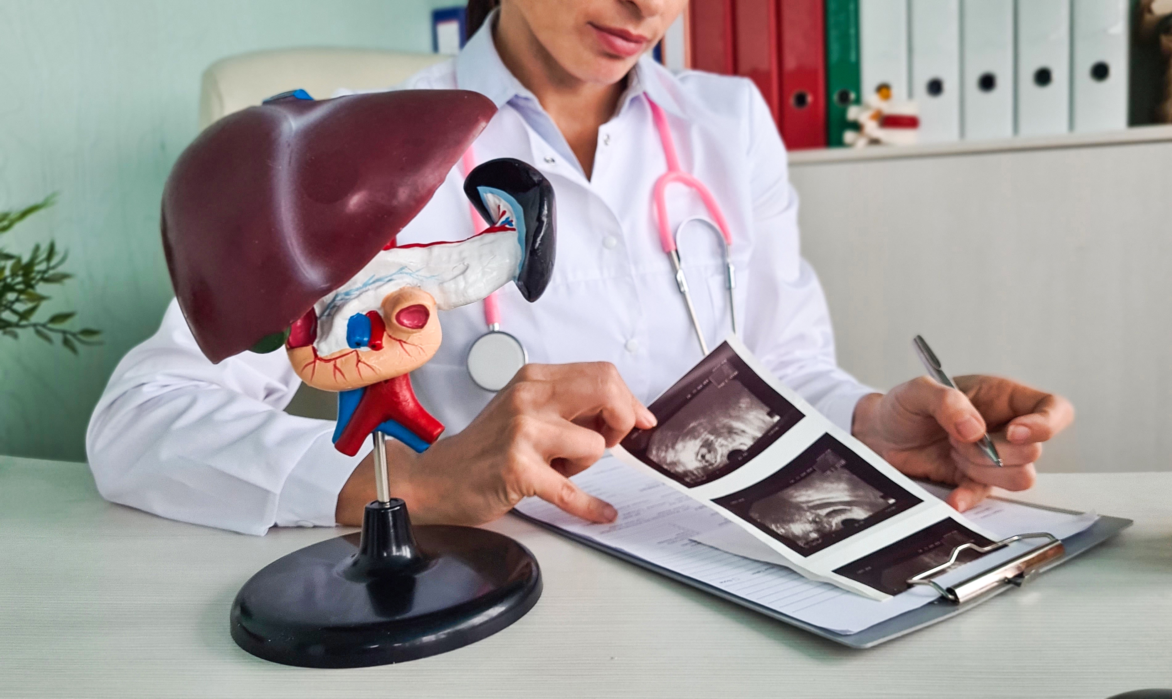 Trombocitopenia în boala hepatică cronică: mecanisme fiziopatologice, implicații clinice și strategii de management
