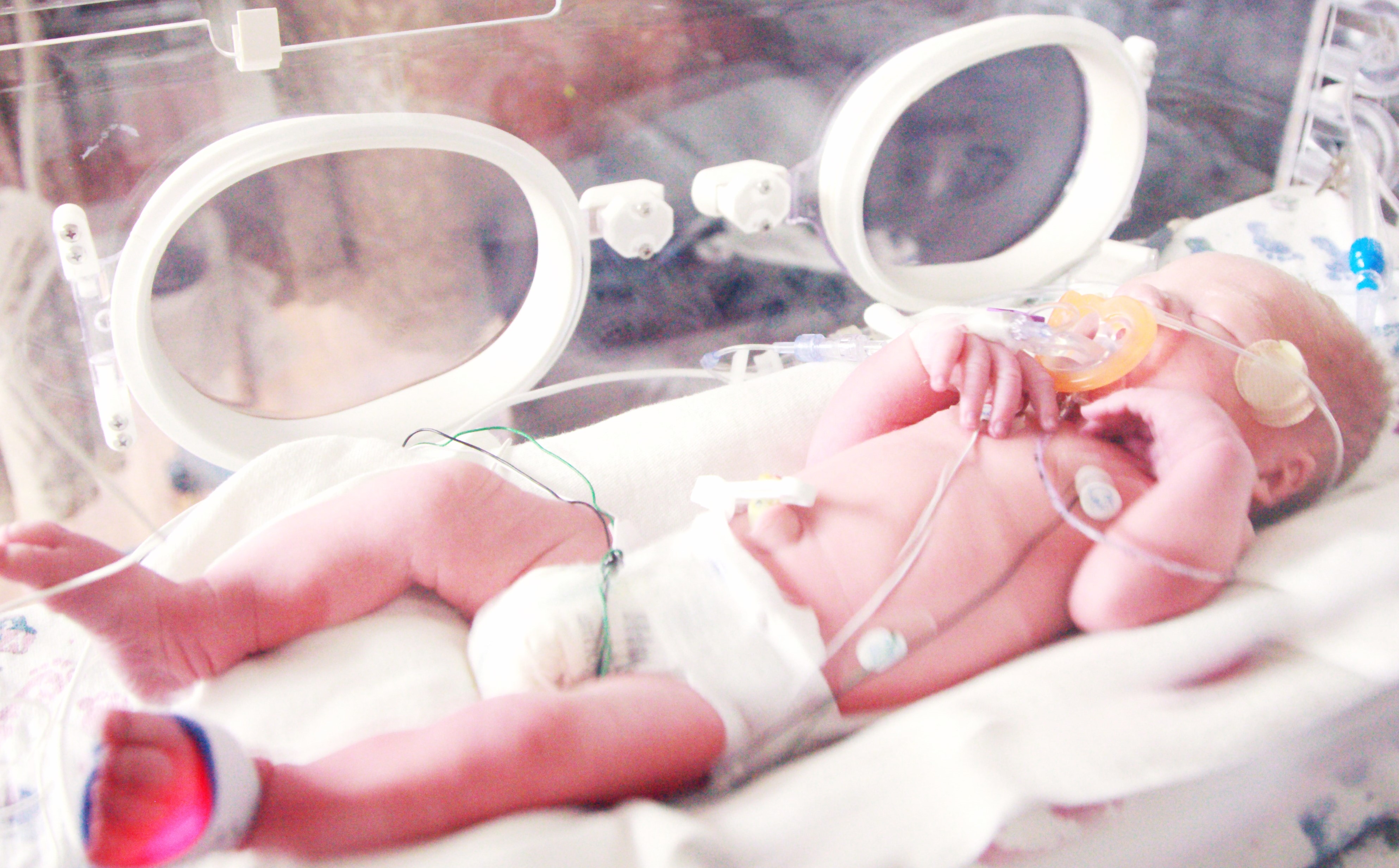 Secţia de Terapie intensivă nou-născuţi a SCJU Bihor, în reţeaua naţională de telemedicină