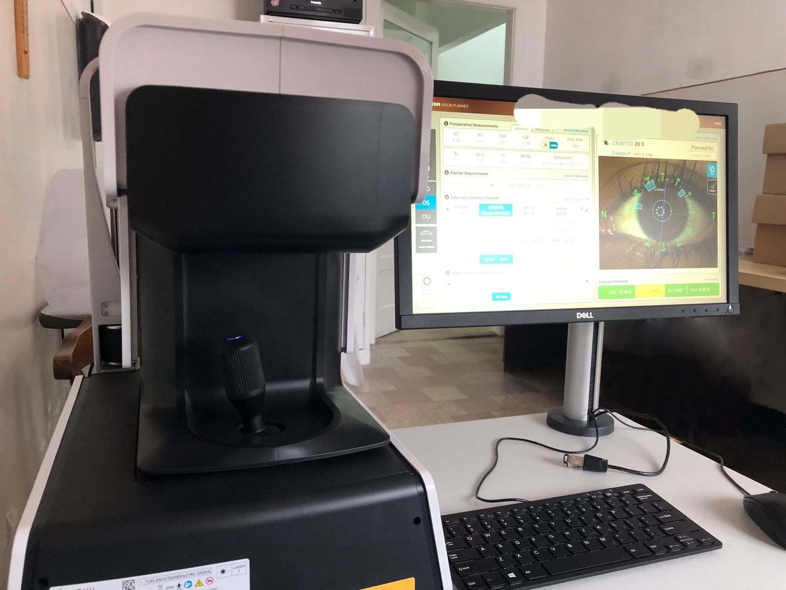 Biometru optic, funcțional din această lună la Arad - Ce beneficii are aparatul