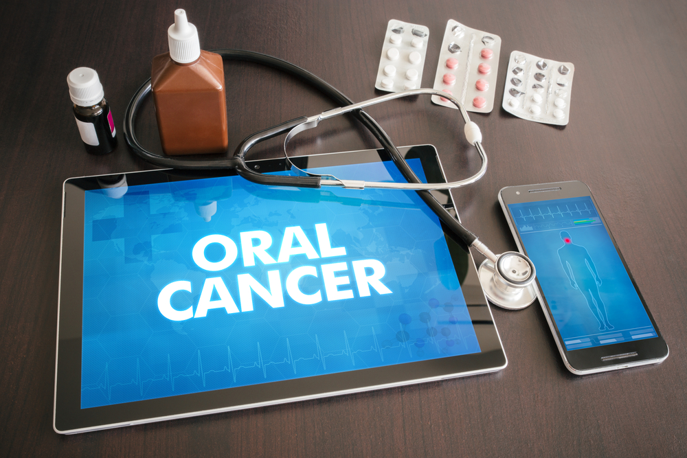 Diagnosticul și tratamentul cancerului oral, în dezbaterea specialiștilor