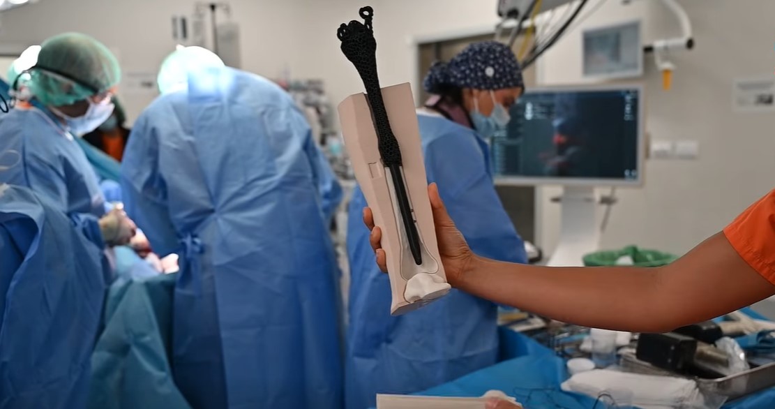 Premieră mondială: A fost creată prima proteză osoasă personalizată din metamaterial 