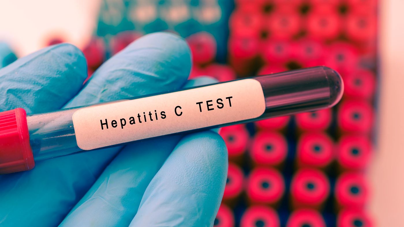 Statele Unite vor să elimine hepatita C până în 2030 