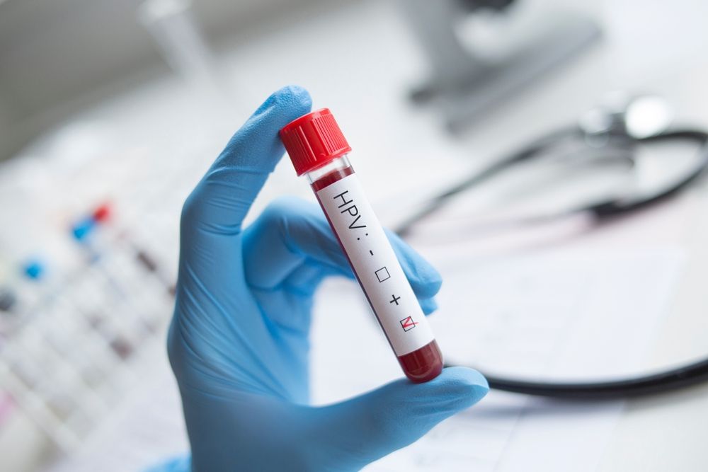 Șase din zece adolescente se infectează cu HPV la primul contact sexual