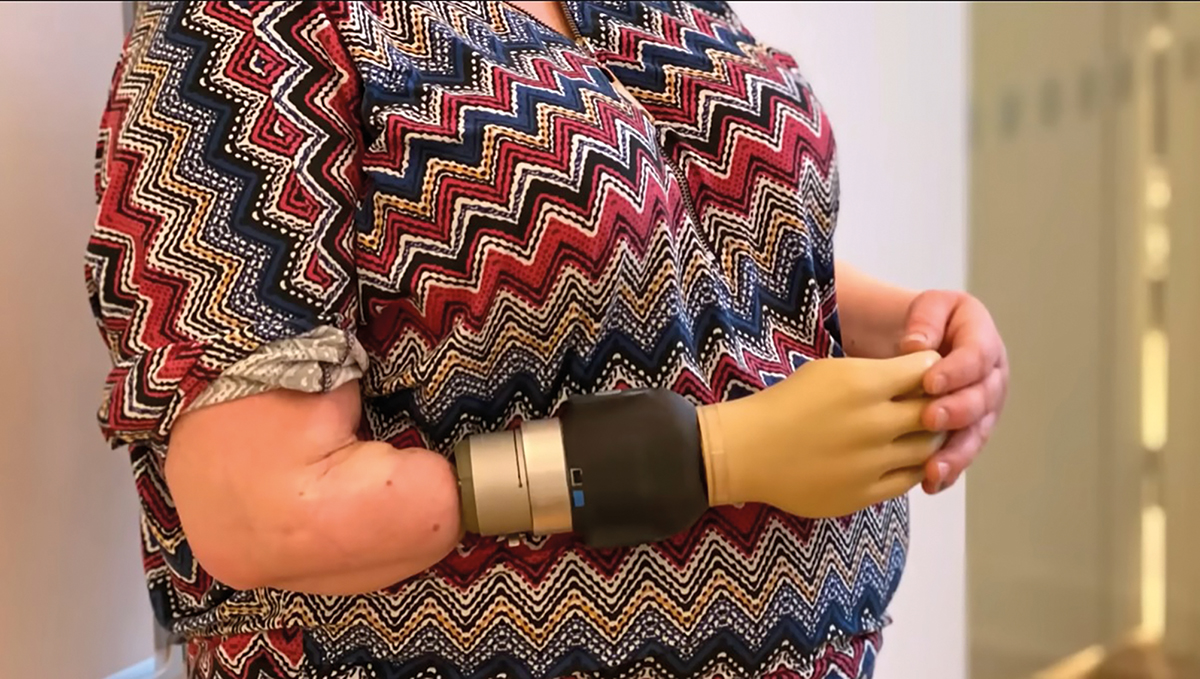 Mână bionică revoluţionară