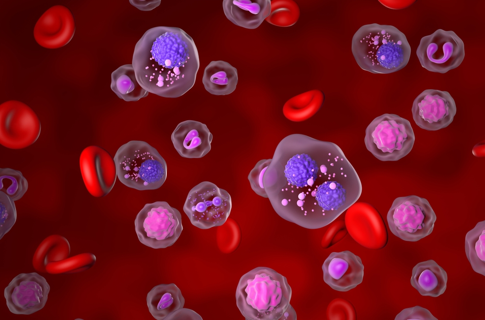 Campanie: „Zi de zi cu mielomul multiplu”