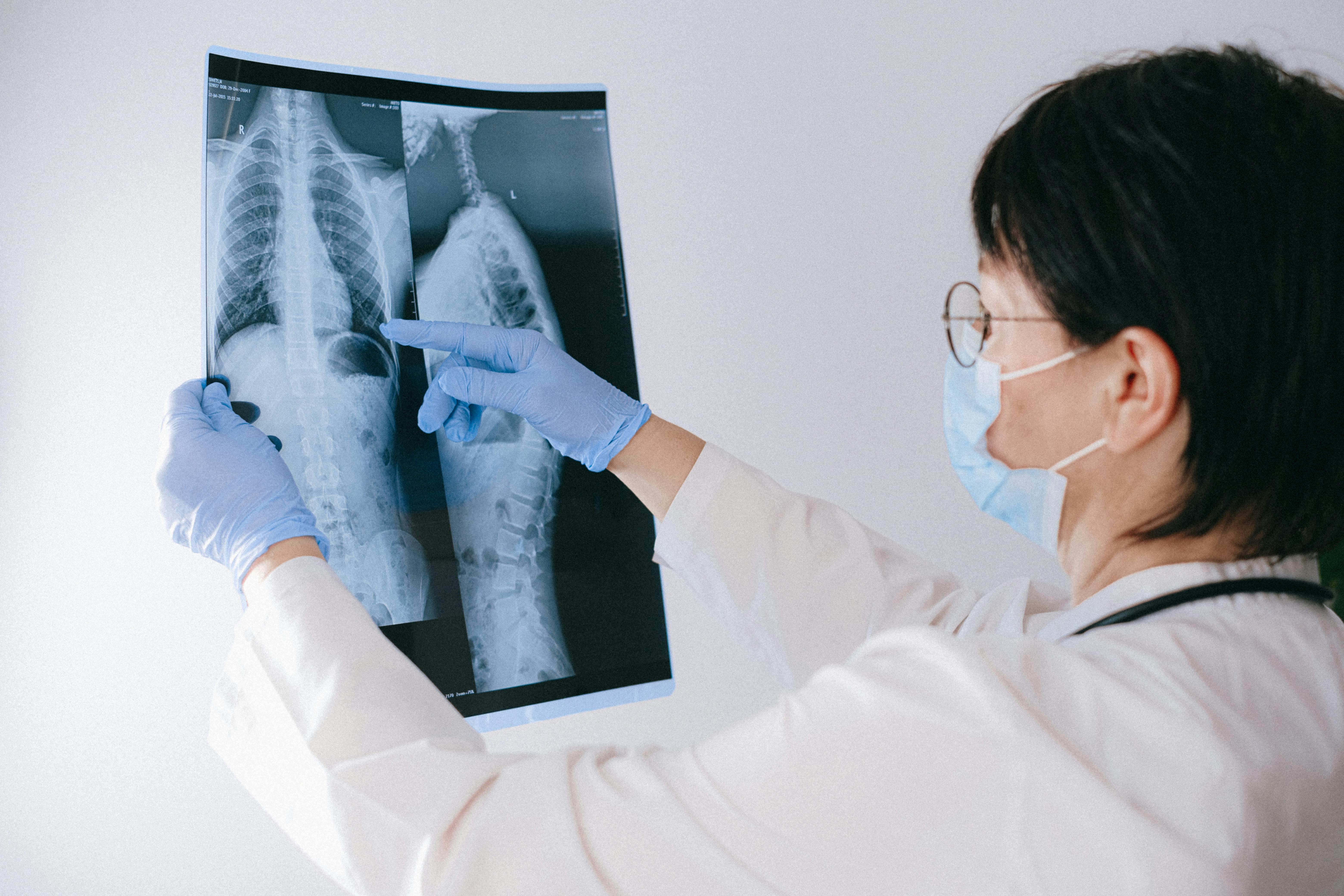 De la somon la tuberculoza necontagioasă
