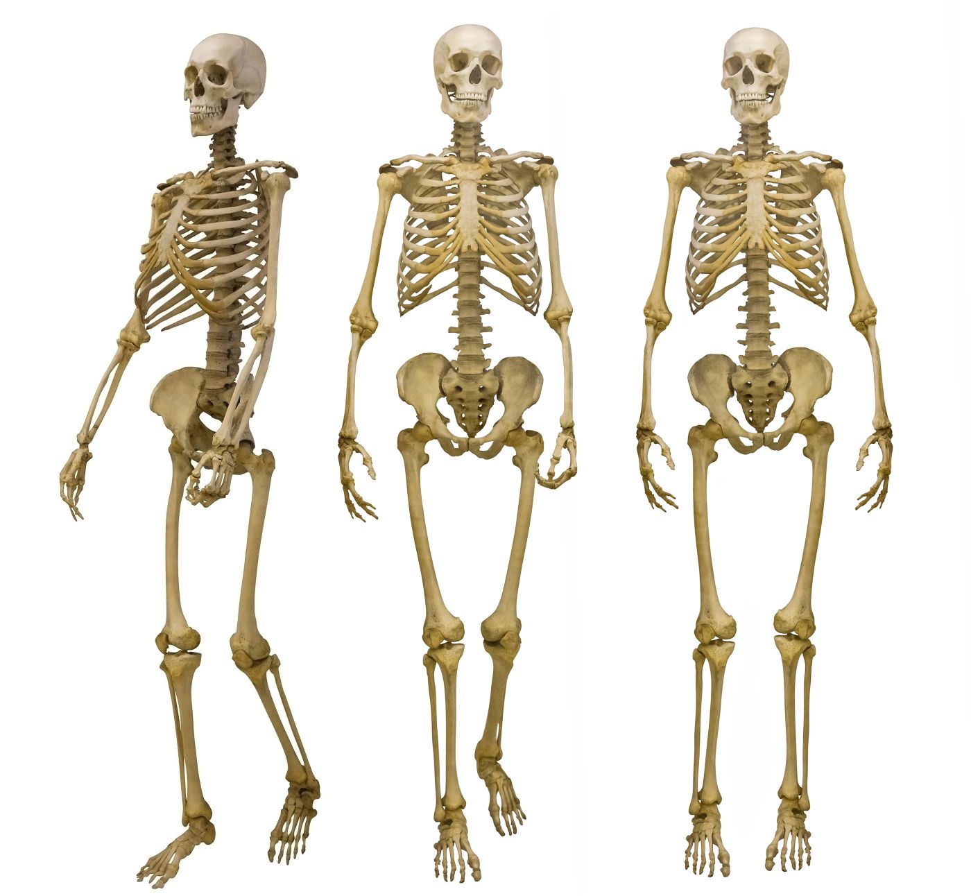 Între 30 și 50% din proporțiile scheletului uman sunt ereditare (studiu)