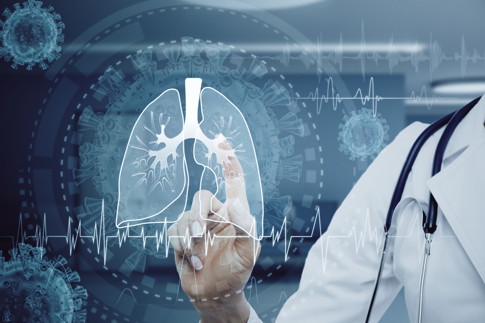 Jumătate dintre participanții la un proiect de screening bronhopulmonar, la risc de a face cancer