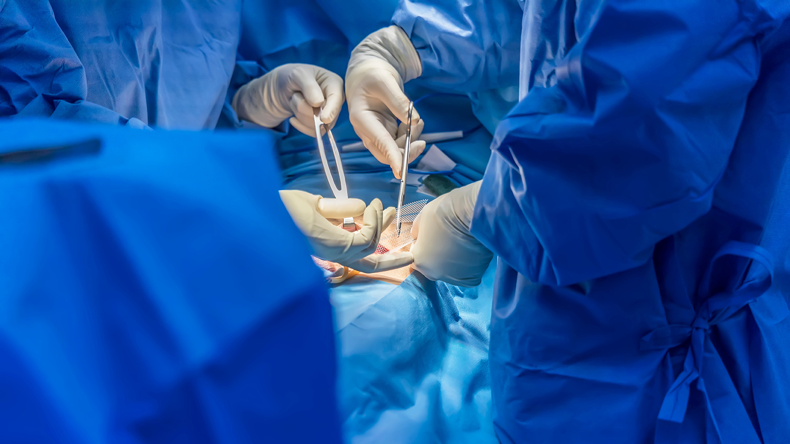 Managementul durerii cronice post-herniorafie - de la etiopatogenie la strategii moderne de diagnostic și tratament