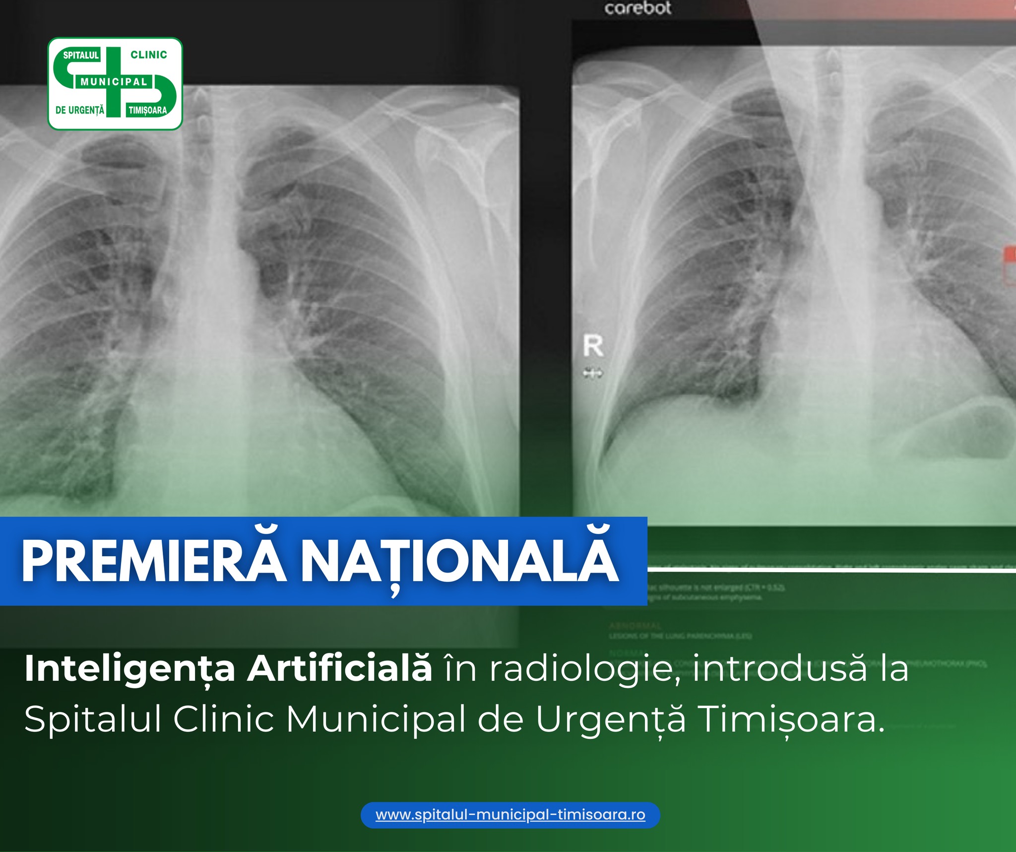 Premieră națională: sistem informatic cu inteligenţă artificială, la un spital din Timișoara