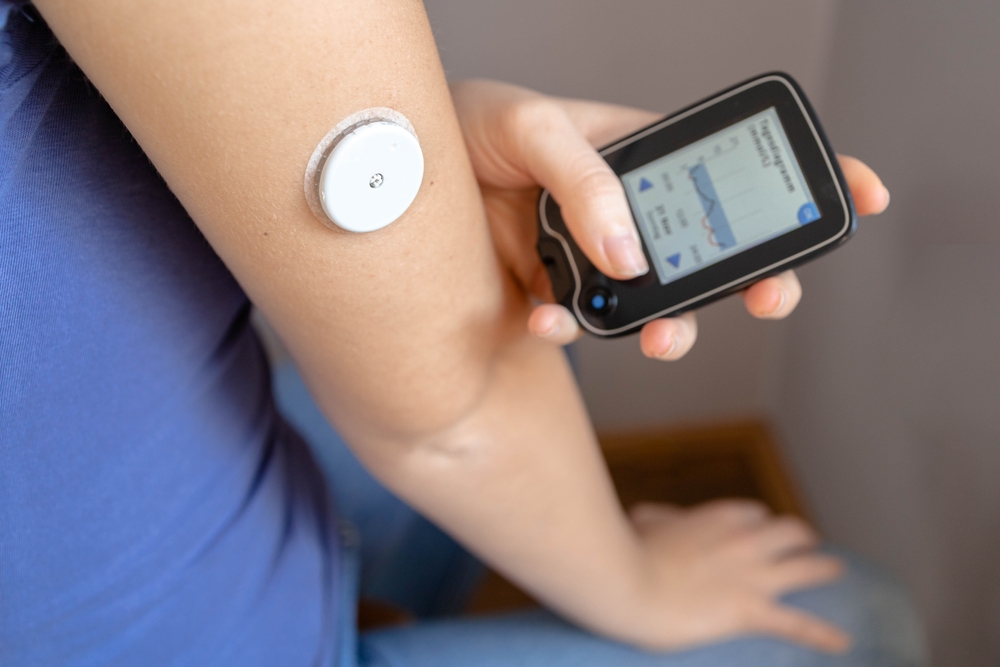 FDA a aprobat primul senzor de monitorizare continua a glicemiei fără prescripție pentru copii