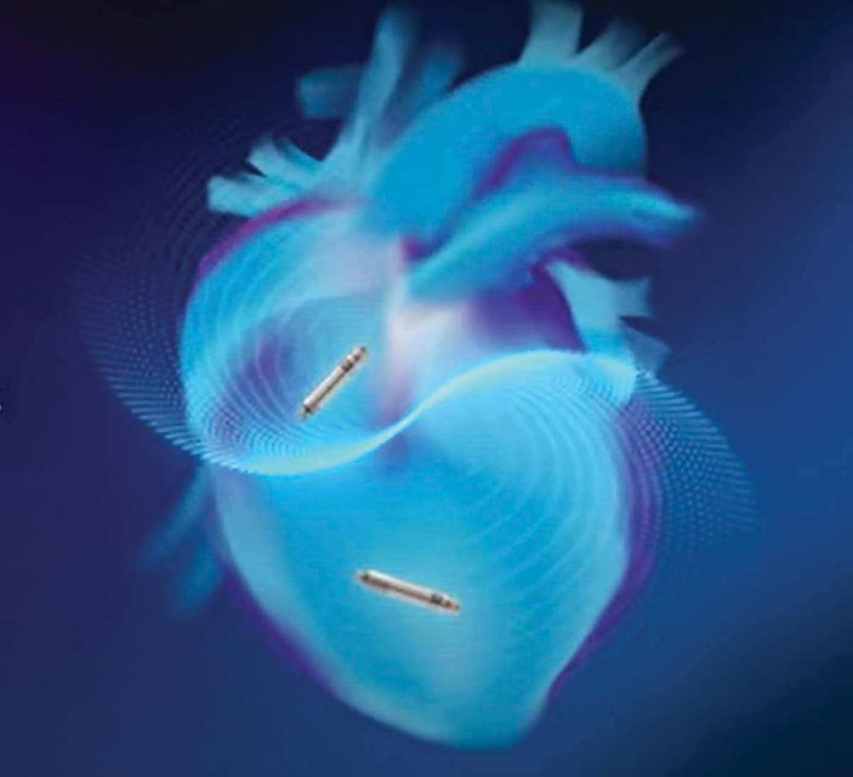 Primul pacemaker bicameral fără fire