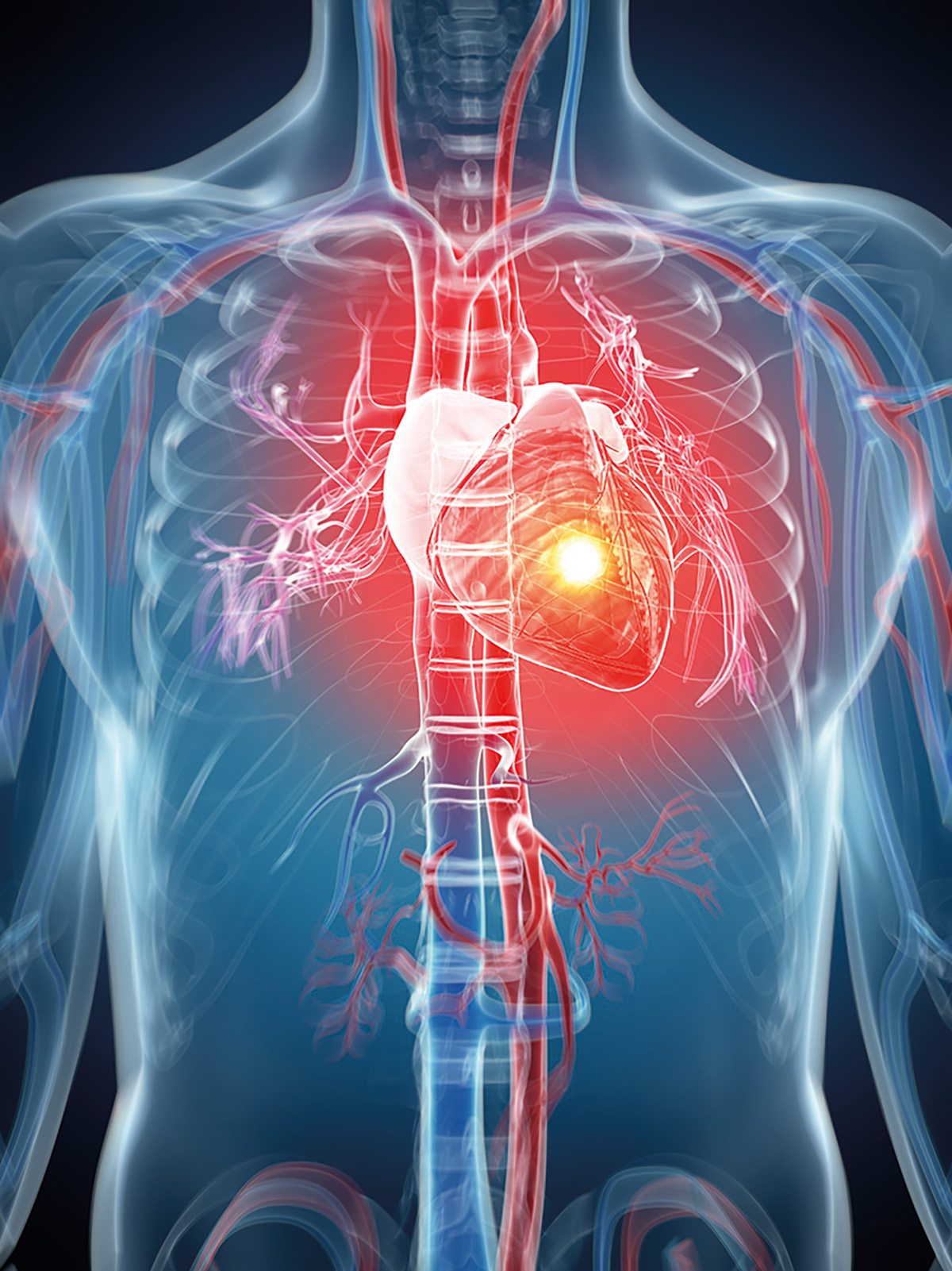 Bărbaţii și femeile au simptome diferite înaintea unui stop cardiac