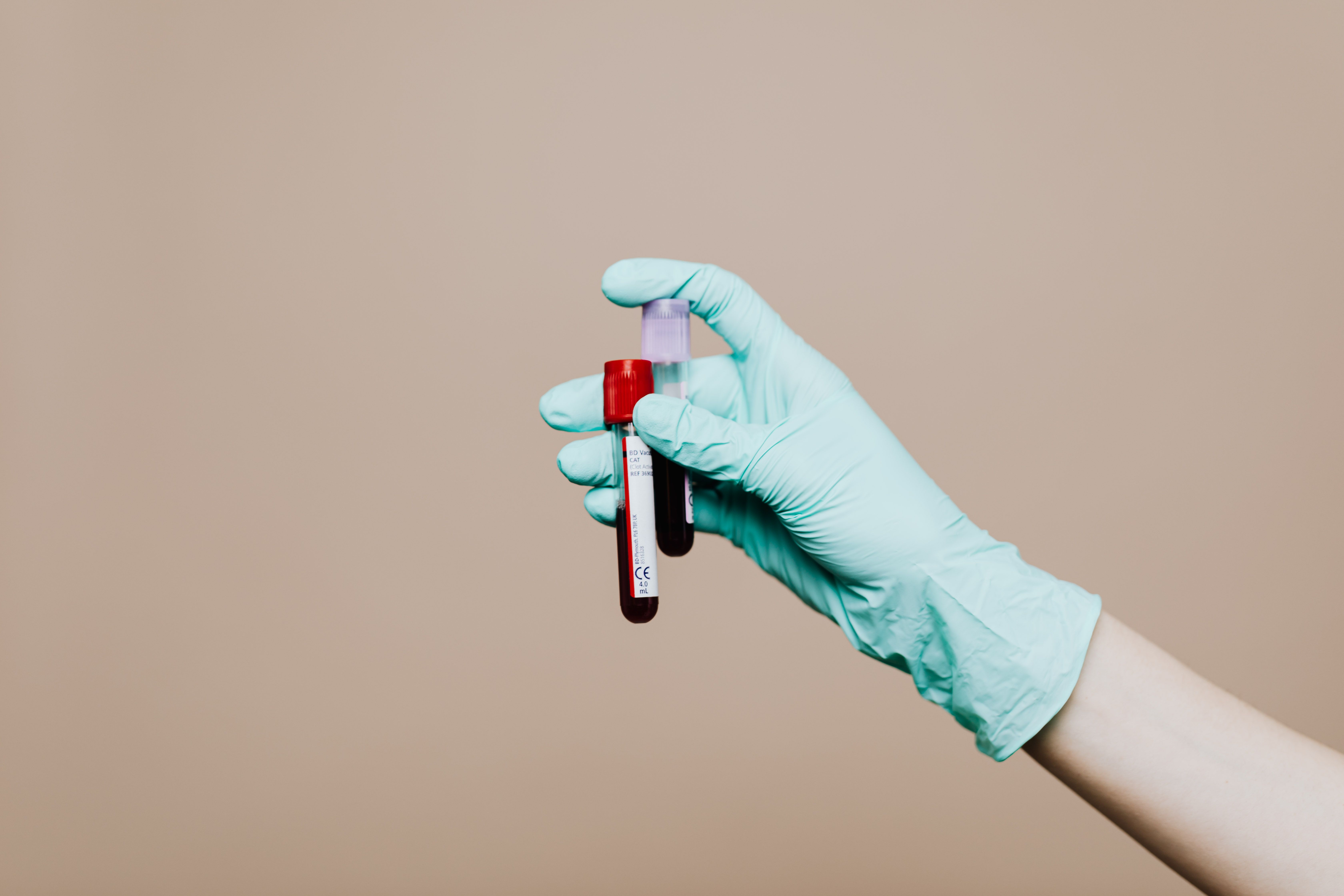 Testare gratuită pentru boli hepatice și cancer colorectal, în Ilfov