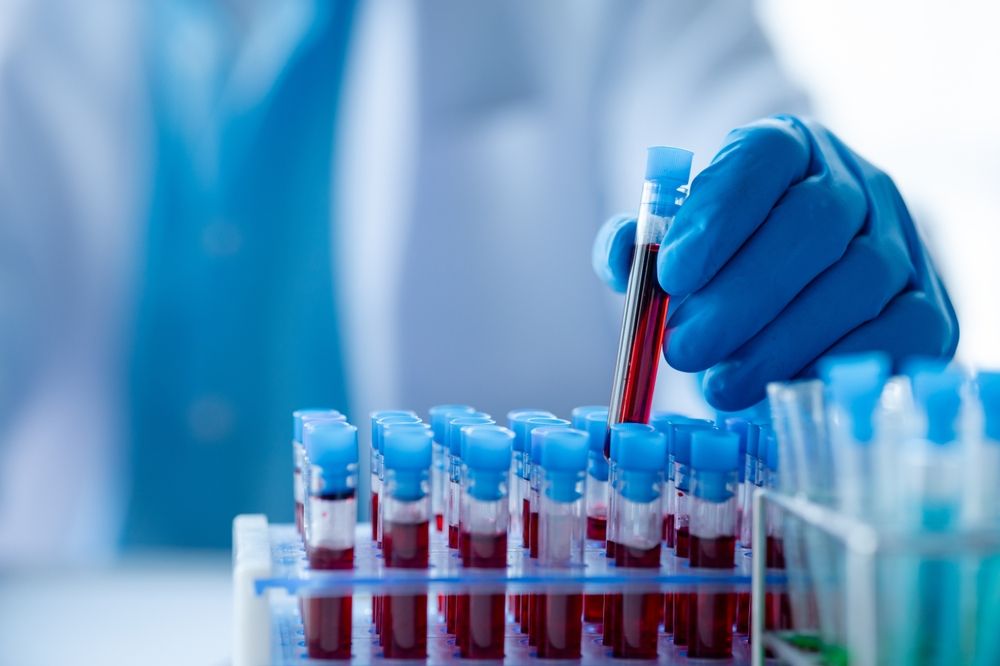 Leziuni precanceroase, detectate printr-un test de sânge