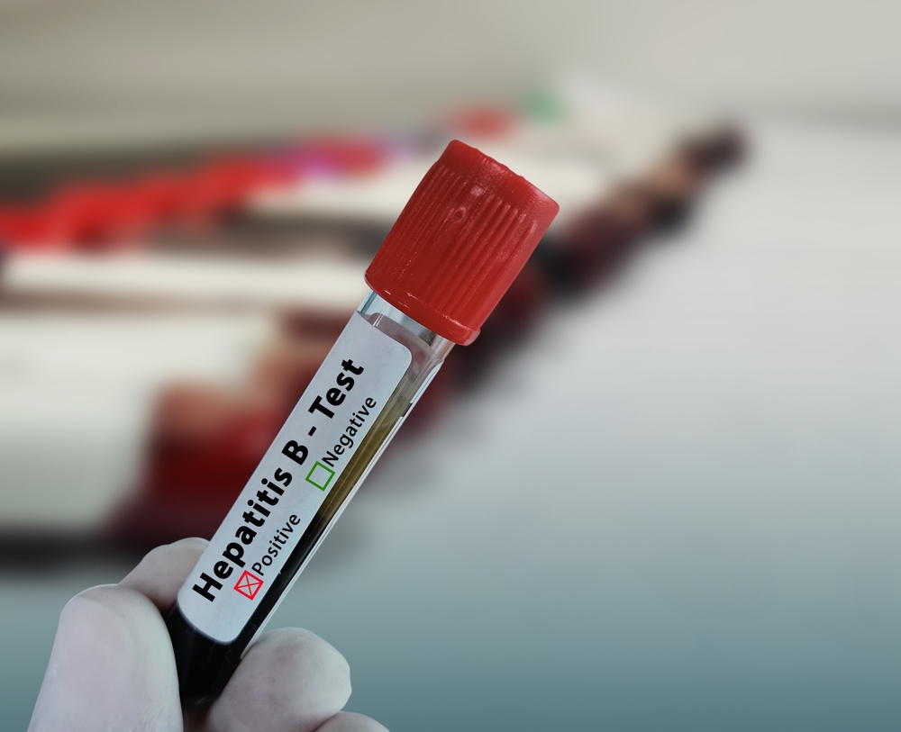 Testări gratuite pentru hepatitele virale