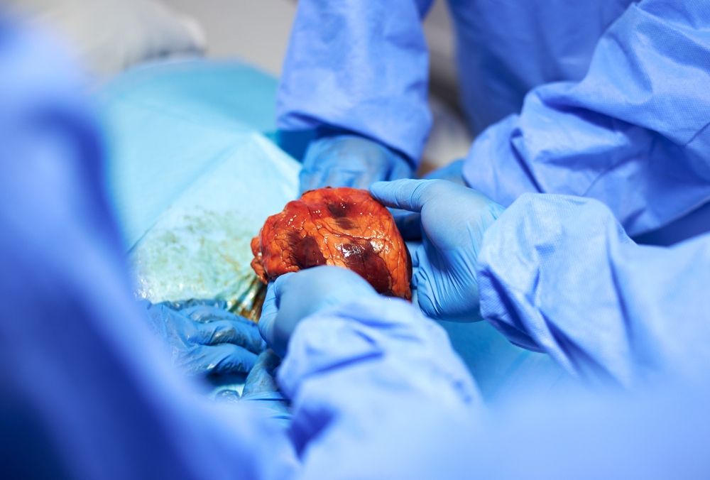 Primul transplant de cord din Iași